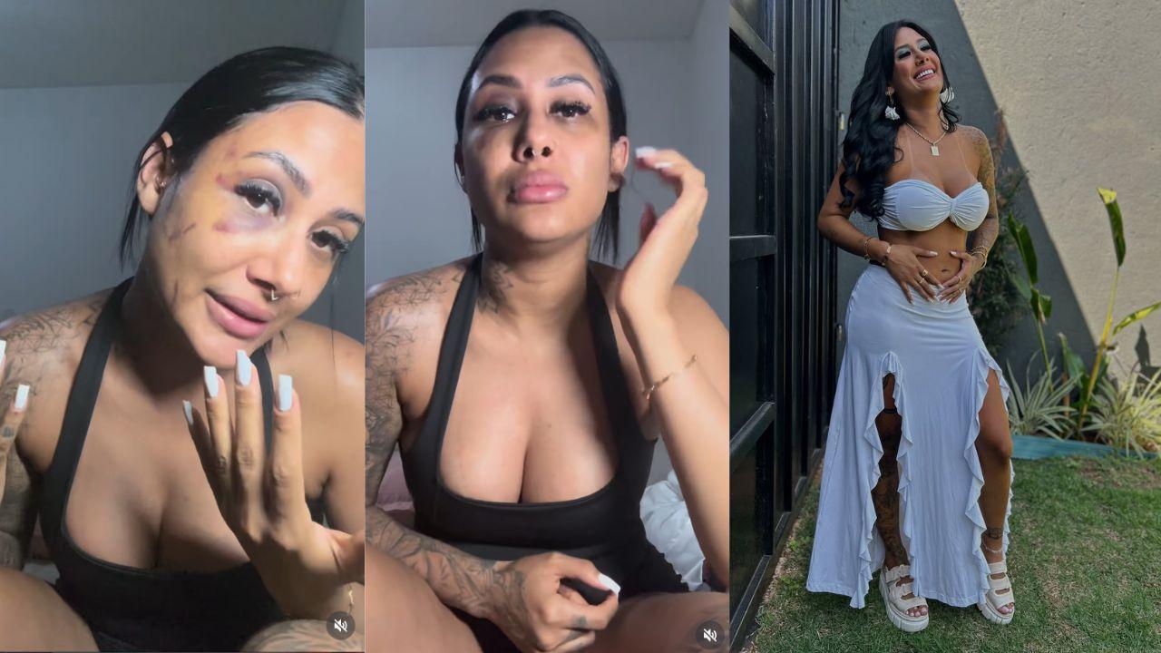 Influenciadora Bárbara Lasmar. Mulher branca, com marcas roxas no rosto.