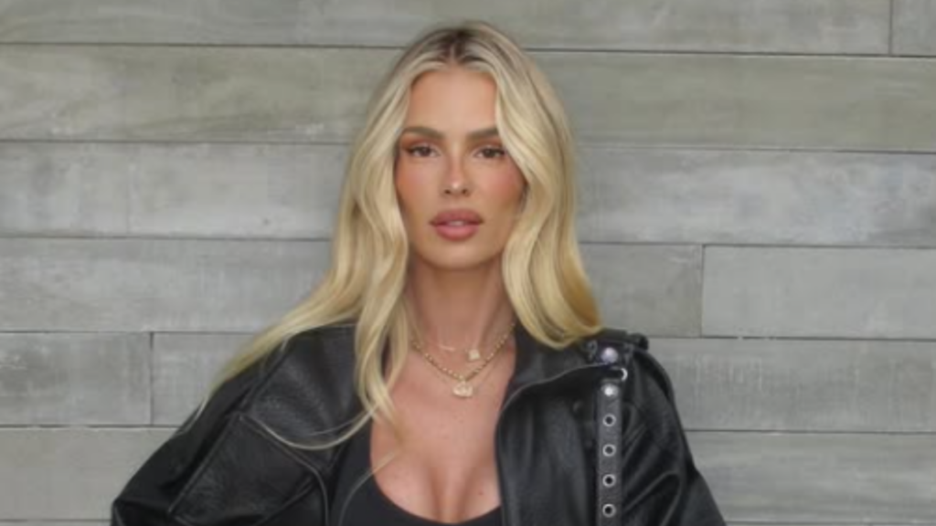 Yasmin Brunet mostra antes e depois após perder 25 kg e tratar lipedema