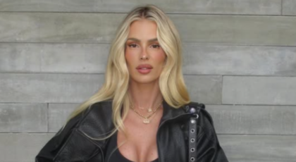 Yasmin Brunet mostra antes e depois após perder 25 kg e tratar lipedema