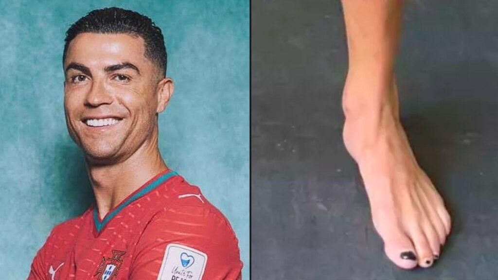 Por que Cristiano Ronaldo pinta as unhas dos pés de preto?